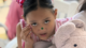 This National Cleft and Craniofacial Awareness Month, Australian PACU nurse Alison Cooper shares her experience volunteering at our Cebu Centre of Excellence. During this program, 100 patients wer (55)